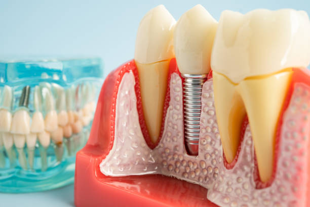 Best Dental Studio in Torrance, CA